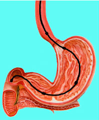 gastroscan